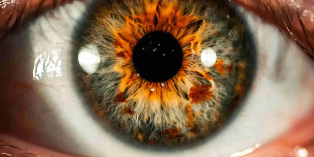 Retina treatment in esthetix dental best retina treatment at Sai Nethralaya
